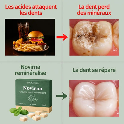 Novirna™ - Chewing-gum reminéralisant