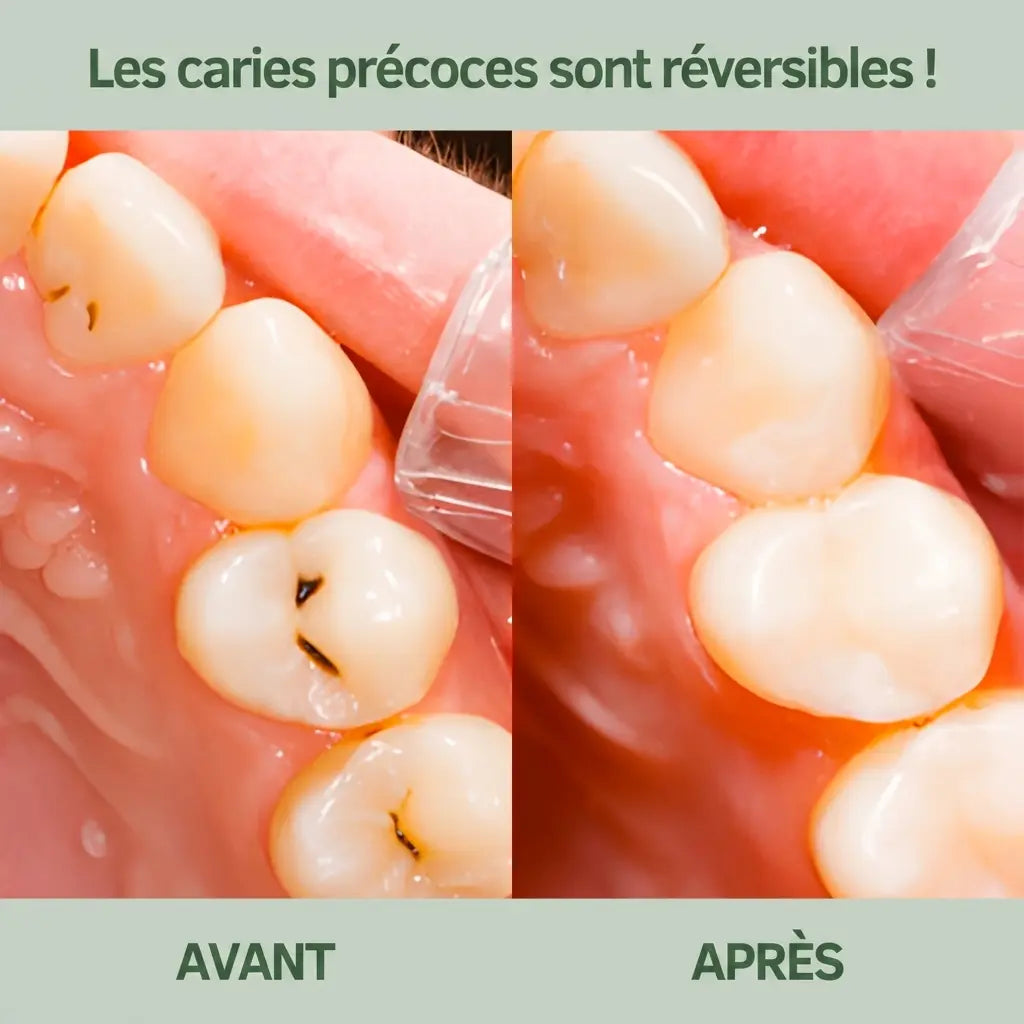 Novirna™ - Chewing-gum reminéralisant