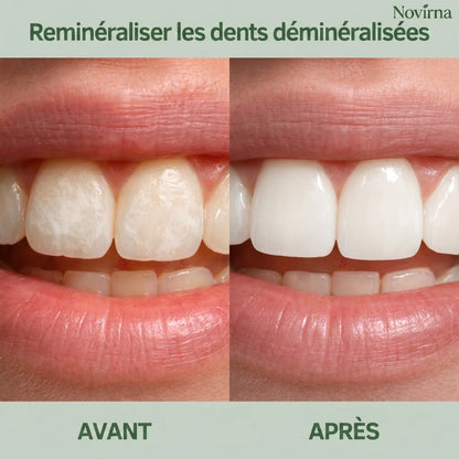 Novirna™ - Chewing-gum reminéralisant